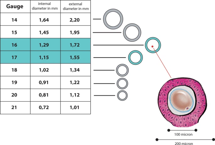 A visual comparison of different egg retrieval needle sizes, from 16G to 20G, used in IVF procedures. A visual comparison of different egg retrieval needle sizes, from 16G to 20G, used in IVF procedures.